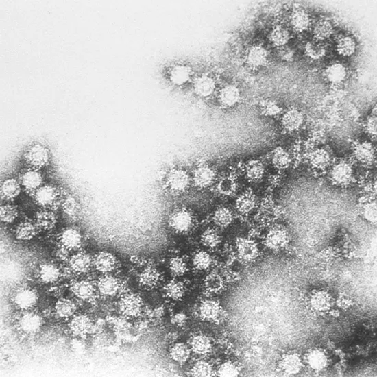 coxsackie b virus